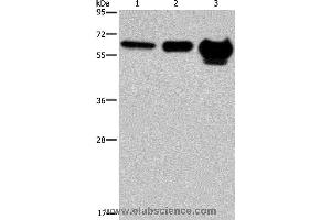 Western blot analysis of 823 cell, mouse brain and human fetal brain tissue, using MMP20 Polyclonal Antibody at dilution of 1:400 (MMP20 antibody)