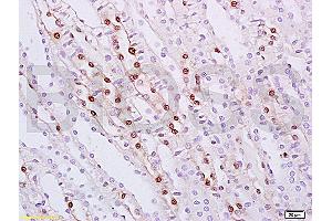 Formalin-fixed and paraffin embedded rat kidney tissue labeled with Anti ZHX2/Alpha fetoprotein regulator 1 Polyclonal Antibody, Unconjugated (ABIN873226) at 1:100 followed by conjugation to the secondary antibody and DAB staining (ZHX2 antibody  (AA 451-550))