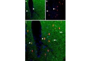 Expression of Adenosine A1 Receptor in rat cortex - Immunohistochemical staining of rat cortex frozen section using Anti-Adenosine A1 Receptor Antibody (ABIN7042882, ABIN7043894 and ABIN7043895). (ADORA1 antibody  (3rd Intracellular Loop))