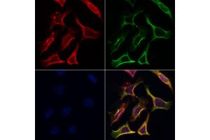 ABIN6265555 and ABIN6266853 staining Hela by IF/ICC.