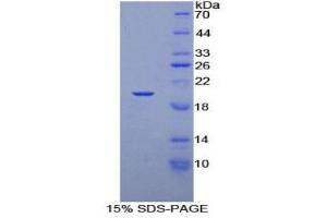 SDS-PAGE (SDS) image for Transcription Elongation Factor B (SIII), Polypeptide 3 (110kDa, Elongin A) (TCEB3) (AA 200-344) protein (His tag) (ABIN1879723) (TCEB3 Protein (AA 200-344) (His tag))
