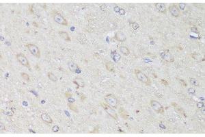 Immunohistochemistry of paraffin-embedded Mouse brain using GANAB Polyclonal Antibody at dilution of 1:150 (40x lens). (GANAB antibody)