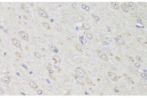 Immunohistochemistry of paraffin-embedded Mouse brain using GANAB Polyclonal Antibody at dilution of 1:150 (40x lens).