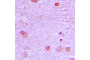 Immunohistochemical analysis of NCOA7 staining in human brain formalin fixed paraffin embedded tissue section. (NCOA7 antibody  (Center))