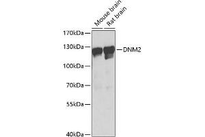 Western blot analysis of extracts of various cell lines, using DNM2 Antibody (ABIN6127773, ABIN6139741, ABIN6139742 and ABIN6223876) at 1:1000 dilution.