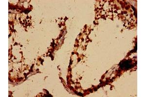 Immunohistochemistry analysis of human testis tissue using ABIN7143886 at dilution of 1:100 (ALKBH3 antibody  (AA 1-170))