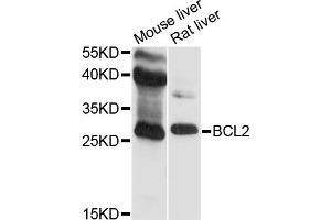Western blot analysis of extracts of various cell lines, using BCL2 antibody (ABIN5970041) at 1/500 dilution. (Bcl-2 antibody)