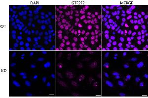 Immunocytochemical staining of HeLa cells using GTF2F2 antibody (ABIN7798708), 1:1,000), Top panel: wild-type (WT), Bottom panal: GTF2F2 shRNA knockdown (KD). (Recombinant GTF2F2 antibody)