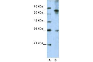 WB Suggested Anti-WNT9B Antibody Titration:  5.