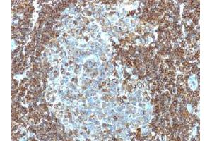 Immunohistochemical staining (Formalin-fixed paraffin-embedded sections) of human tonsil with CD3E monoclonal antibody, clone PC3/188A . (CD3 epsilon antibody  (Cytoplasmic Domain))