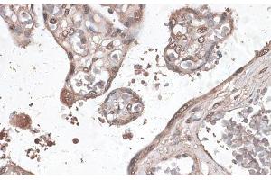 Immunohistochemistry of paraffin-embedded Human placenta using MEF2C Polyclonal Antibody at dilution of 1:100 (40x lens). (MEF2C antibody)