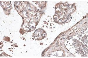 Immunohistochemistry of paraffin-embedded Human placenta using MEF2C Polyclonal Antibody at dilution of 1:100 (40x lens).