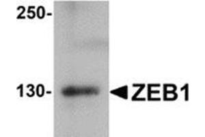 Western blot analysis of ZEB1 in HeLa cell lysate with ZEB1 antibody at 1 μg/ml.