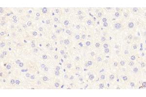 Detection of STAT3 in Mouse Liver Tissue using Polyclonal Antibody to Signal Transducer And Activator Of Transcription 3 (STAT3)