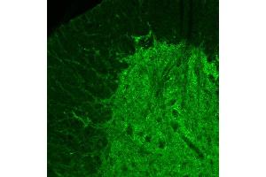 Indirect immunolabeling of PFA fixed mouse spinal chord vibratome section (dilution 1 : 300) (RAB3A antibody  (AA 154-227))