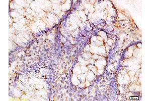 Formalin-fixed and paraffin embedded human rectal tissue labeled with Anti-Adiponectin Receptor 2 Polyclonal Antibody, Unconjugated (ABIN670851) at 1:300, followed by conjugation to the secondary antibody and DAB staining (Adiponectin Receptor 2 antibody  (AA 315-340))