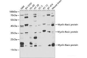 Western blot analysis of extracts of various cell lines using Myelin Basic protein Polyclonal Antibody at dilution of 1:1000. (MBP antibody)