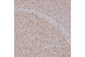 IHC analysis of TRMT61A using anti-TRMT61A antibody (ABIN7599220). (TRMT61A antibody  (AA 1-289))