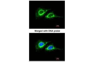 ICC/IF Image Immunofluorescence analysis of paraformaldehyde-fixed HeLa, using Cytokeratin 18 , antibody at 1:200 dilution. (Cytokeratin 18 antibody)