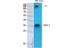 Western Blotting (WB) image for anti-Suppressor of Cytokine Signaling 1 (SOCS1) (Internal Region) antibody (ABIN3187018) (SOCS1 antibody  (Internal Region))