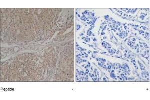 Image no. 1 for anti-SMAD, Mothers Against DPP Homolog 3 (SMAD3) (Ser208) antibody (ABIN319357) (SMAD3 antibody  (Ser208))
