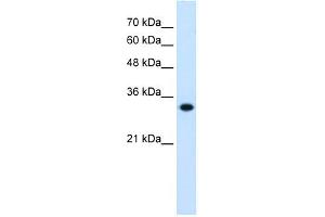 HMGCL antibody used at 0. (HMGCL antibody)