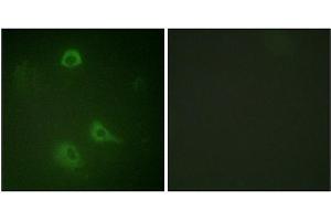 Immunofluorescence staining of methanol-fixed A549 cells using NMDAR1 (Phospho-Ser890) Antibody. (GRIN1/NMDAR1 antibody  (pSer890))
