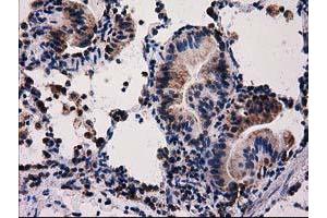 Image no. 5 for anti-Family with Sequence Similarity 127, Member C (FAM127C) antibody (ABIN1498197) (FAM127C antibody)