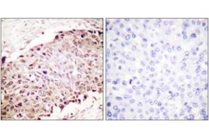 Immunohistochemistry (Paraffin-embedded Sections) (IHC (p)) image for anti-Small Ubiquitin Related Modifier Protein 1 (SUMO1) (AA 1-50) antibody (ABIN1533443)
