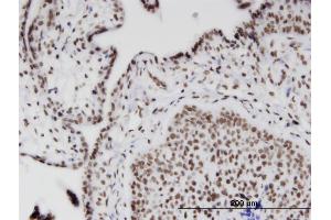 Immunoperoxidase of monoclonal antibody to RIOK2 on formalin-fixed paraffin-embedded human placenta. (RIOK2 antibody  (AA 453-551))