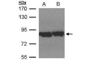 WB Image Sample(30 μg of whole cell lysate) A:Hep G2, B:MOLT4, 7. (TRAP1 antibody)