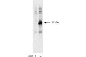 Image no. 1 for anti-HA-Tag antibody (ABIN793576) (HA-Tag antibody)