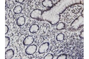 Immunoperoxidase of monoclonal antibody to PCGF3 on formalin-fixed paraffin-embedded human small Intestine. (PCGF3 antibody  (AA 133-242))