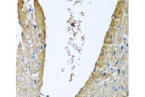 Immunohistochemistry of paraffin-embedded Mouse heart using COX5B Polyclonal Antibody at dilution of 1:100 (40x lens). (COX5B antibody)