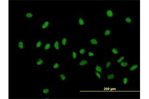 Immunofluorescence of purified MaxPab antibody to ZHX1 on HeLa cell. (ZHX1 antibody  (AA 1-873))