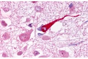 Image no. 1 for anti-Galanin Receptor 1 (GALR1) (Extracellular Domain) antibody (ABIN1048642) (Galanin Receptor 1 antibody  (Extracellular Domain))