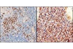 Immunohistochemistry (IHC) image for Rabbit anti-Human Ig (C-Term), (Chain kappa), (Light Chain) antibody (ABIN870372) (Rabbit anti-Human Ig (C-Term), (Chain kappa), (Light Chain) Antibody)