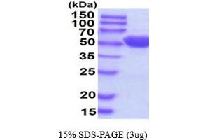 SDS-PAGE (SDS) image for Alanine Aminotransferase (ALT) (AA 1-496) (Active) protein (His tag) (ABIN7529284)