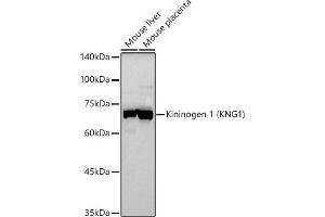 Western blot analysis of extracts of various cell lines, using Kininogen 1 (KNG1) antibody (ABIN3022363, ABIN3022364, ABIN3022365 and ABIN6218762) at 1:500 dilution. (KNG1 antibody  (AA 148-427))