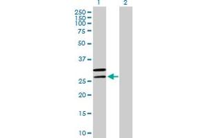 Western Blot analysis of MRPL2 expression in transfected 293T cell line by MRPL2 MaxPab polyclonal antibody. (MRPL2 antibody  (AA 1-305))
