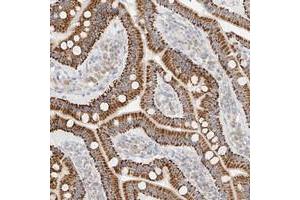 Immunohistochemical staining of human duodenum with CXorf58 polyclonal antibody  strong cytoplasmic positivity in glandular cells at 1:50-1:200 dilution. (CXorf58 antibody)
