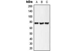 Western blot analysis of ACSL6 expression in HepG2 (A), mouse brain (B), rat brain (C) whole cell lysates. (ACSL6 antibody  (Center))