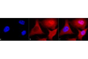 Immunocytochemistry/Immunofluorescence analysis using Mouse Anti-Ubiquitin Monoclonal Antibody, Clone 6C11-B3 (ABIN361817 and ABIN361816). (Ubiquitin antibody)