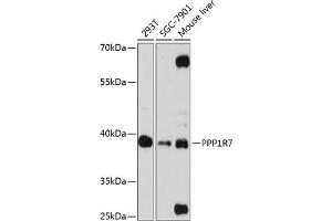 Western blot analysis of extracts of various cell lines, using PPP1R7 antibody (ABIN6132827, ABIN6146072, ABIN6146074 and ABIN6216881) at 1:3000 dilution. (PPP1R7 antibody  (AA 281-360))