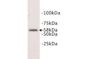 Western Blotting (WB) image for anti-Deoxynucleotidyltransferase, terminal (DNTT) (N-Term) antibody (ABIN1854984)