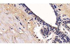 Detection of RIPK1 in Human Mammary gland Tissue using Polyclonal Antibody to Receptor Interacting Serine Threonine Kinase 1 (RIPK1) (RIPK1 antibody  (AA 17-289))