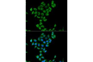 Immunofluorescence analysis of  cells using COQ3 antibody (ABIN6133353, ABIN6138894, ABIN6138895 and ABIN6223356). (COQ3 antibody  (AA 50-369))