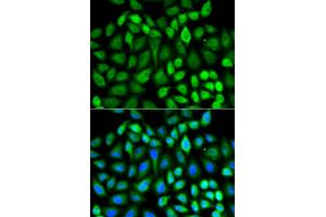 Immunofluorescence analysis of U2OS cells using MAPK3 antibody. (ERK1 antibody)