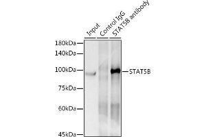 Immunoprecipitation analysis of 300 μg extracts of HeLa cells using 3 μg STB antibody (ABIN7270311). (STAT5B antibody)