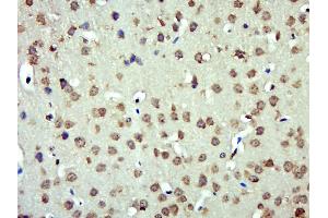 Immunohistochemistry (Paraffin-embedded Sections) (IHC (p)) image for anti-Angiotensinogen (serpin Peptidase Inhibitor, Clade A, Member 8) (AGT) (AA 51-120) antibody (ABIN5675452)